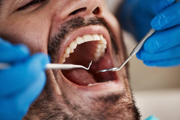 Best Emergency Treatment for Dental Infections or Abscesses in Potomac Mills, VA