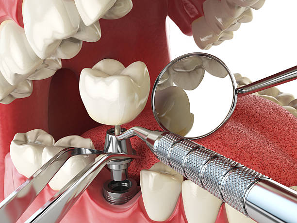 Best Urgent Care for Lost Fillings or Crowns in Potomac Mills, VA
